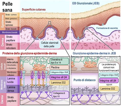 Diagramma che illustra il processo di terapia genica per l'Epidermolisi Bollosa Distrofica Recessiva