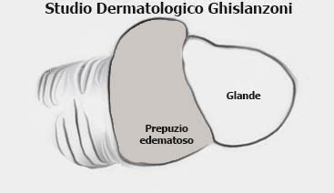 Illustrazione anatomica del pene con focus sulla zona balano-prepuziale