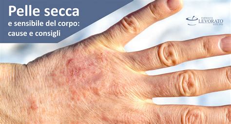 pelle secca e pruriginosa