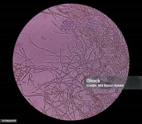 Microscopio che mostra il fungo Malassezia