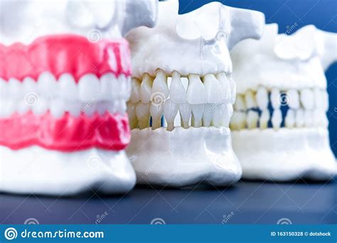 Illustrazione anatomica delle gengive