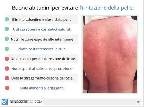 Pelle irritata a causa della chemioterapia