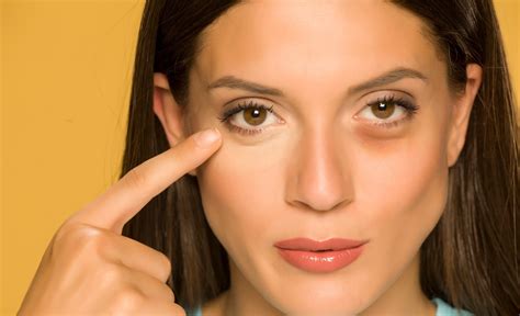 Bambino con occhiaie