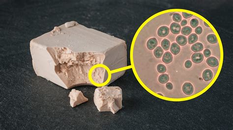 Immagine al microscopio di lieviti Malassezia sulla pelle