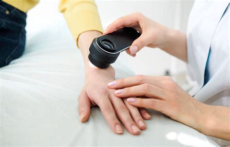 Immagine di un dermatoscopio utilizzato per la mappatura dei nei