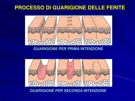 Schema del processo di guarigione della pelle
