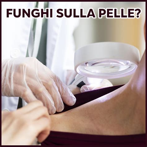 Diagramma che illustra le diverse tipologie di funghi patogeni per la pelle