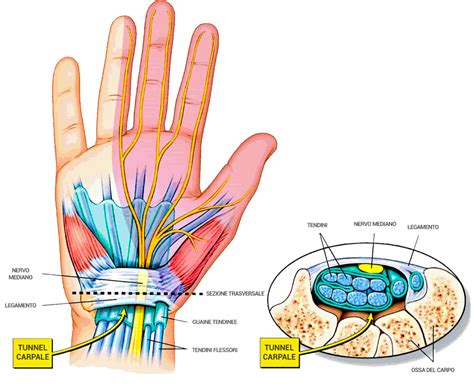 Illustrazione anatomica del tunnel carpale e del nervo mediano