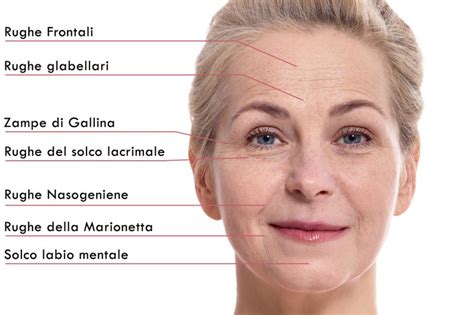 viso di donna con rughe sottili sulla fronte e contorno occhi