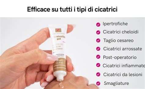 Infografica che illustra le diverse opzioni di trattamento per i cheloidi