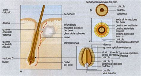 Illustrazione di un follicolo pilifero infiammato con comparsa di pustola
