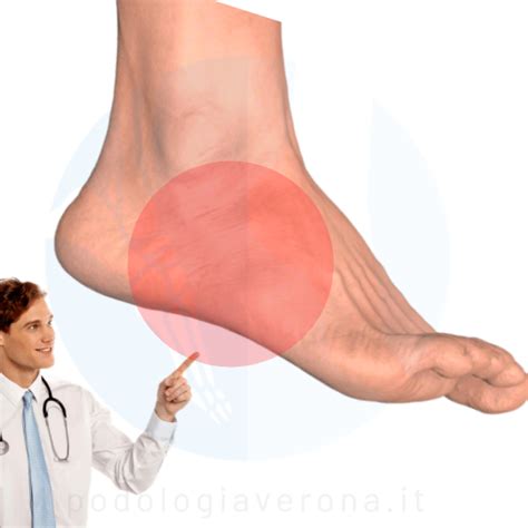 Diagramma che illustra le diverse cause di dolore al lato esterno del piede