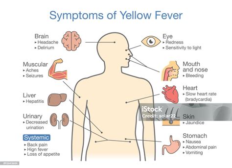 Diagramma dei sintomi dell'infiammazione cutanea