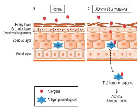 Schema della barriera cutanea con evidenziate ceramidi e filaggrina