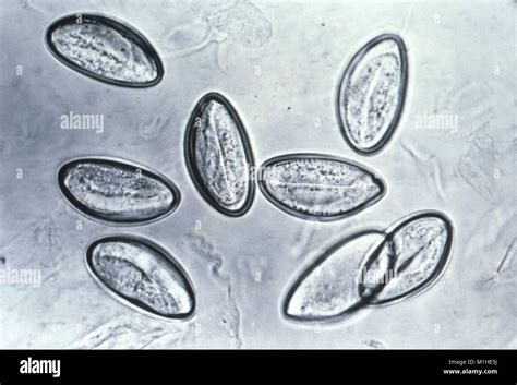 Uova di Enterobius vermicularis al microscopio