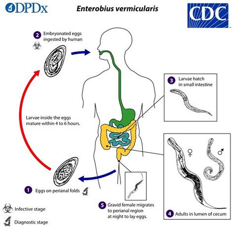 Diagramma del ciclo vitale dell'Enterobius vermicularis