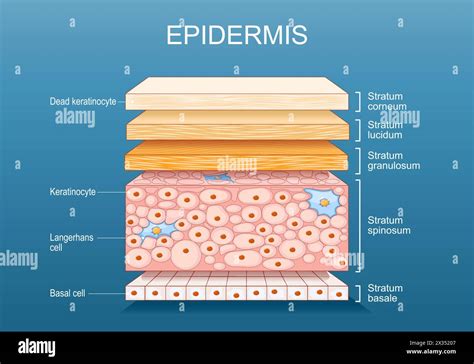 Schema dell'epidermide con lesioni psoriasiche