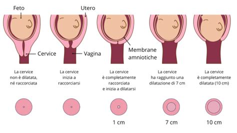 Schema anatomico dell'utero con evidenziata la cervice