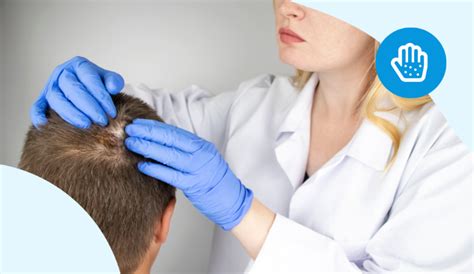 Immagine comparativa di diverse tipologie di alopecia