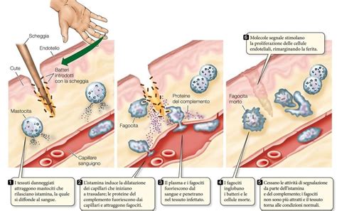 Diagramma del processo infiammatorio nell'artrite psoriasica
