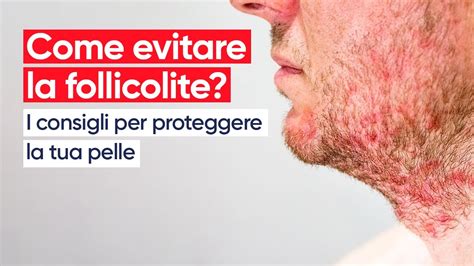 Immagine che mostra la differenza tra follicolite e acne sui glutei