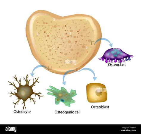 Illustrazione schematica del processo di ferroptosi indotta dalle cellule di melanoma negli osteociti