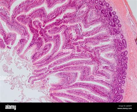 Microscopio che mostra tessuto cicatriziale