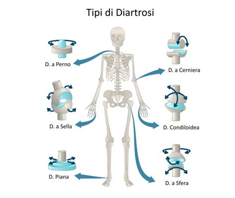 Diagramma delle articolazioni interessate dall'artrosi