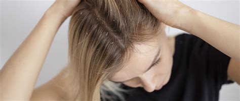 Persona che applica delicatamente uno shampoo su una zona del cuoio capelluto