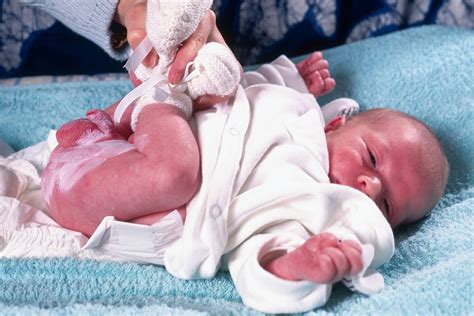 Bambino con arrossamento da pannolino