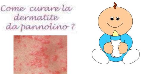 Schema riassuntivo delle cause e rimedi dermatite da pannolino
