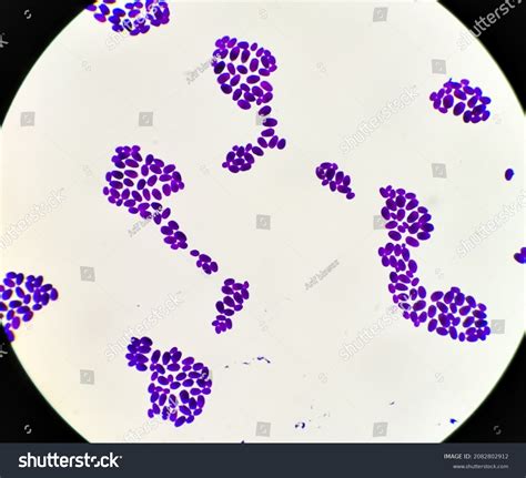 Microscopio che mostra Candida albicans