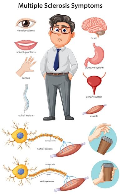 Illustrazione dei sintomi dell'uretrite