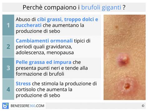 Schema che illustra i fattori che causano i brufoli sulla schiena: sebo, batteri, cellule morte, sudore.