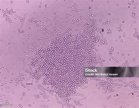 Malassezia furfur microscopio