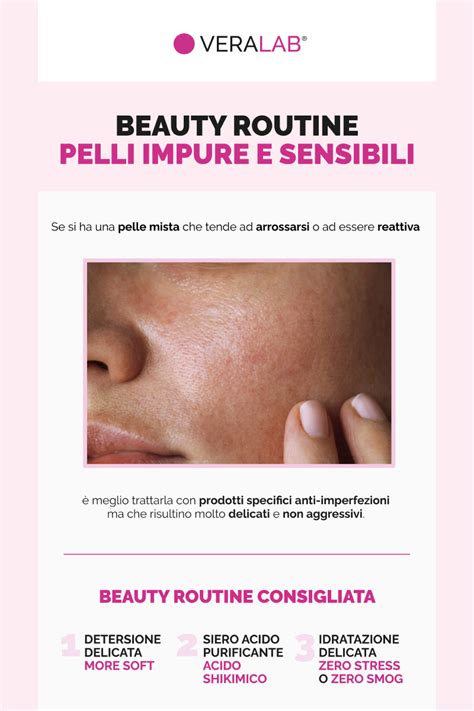 Infografica che illustra una routine skincare ideale per pelli a tendenza acneica.