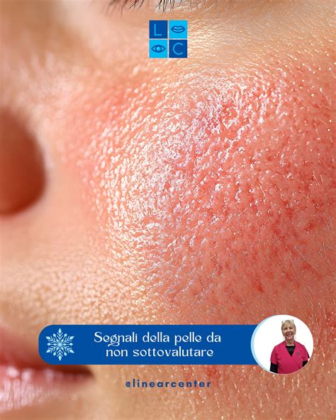 Pelle con rossori visibili