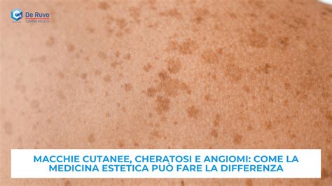 Fattori che causano macchie cutanee