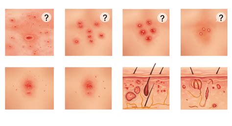 Schema diagnostico per eruzioni cutanee