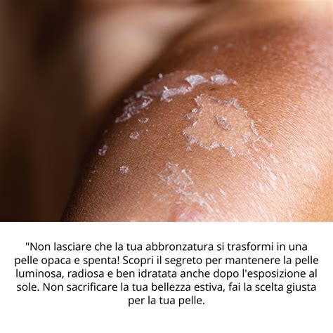 Pelle che si riprende dal sole