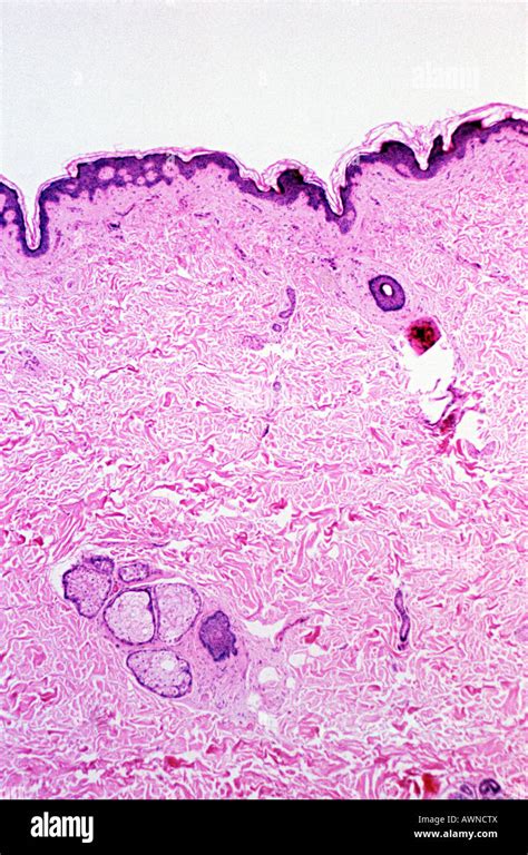 Microscopio che osserva cellule della pelle