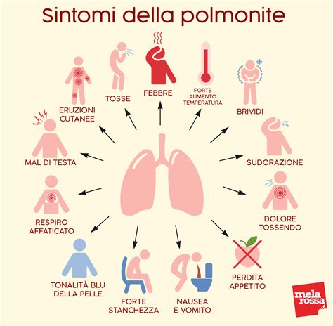 Grafico che illustra i diversi agenti eziologici della polmonite