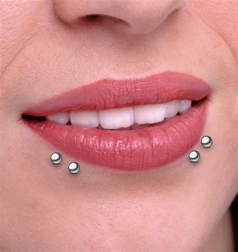 Immagine di un piercing al labbro con una potenziale cicatrice cheloidea