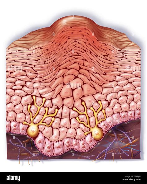 Illustrazione di una Verruca del Nether matura