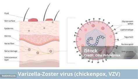 Rappresentazione stilizzata del virus Varicella-Zoster