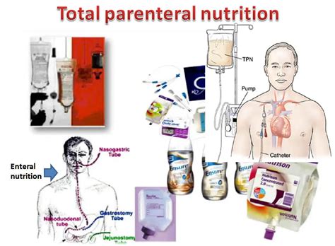 Infografica che mostra i componenti di una soluzione per idratazione parenterale