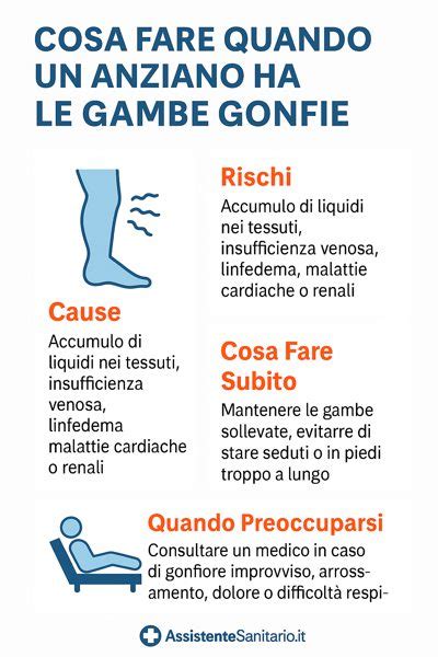 infografica sui rimedi per gambe gonfie