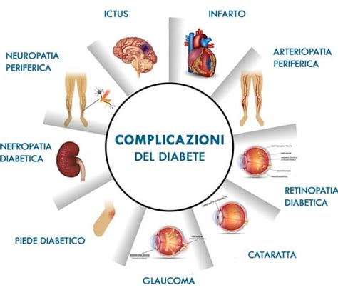 Schema che illustra le due principali complicanze del diabete che portano al piede diabetico: neuropatia e vasculopatia.