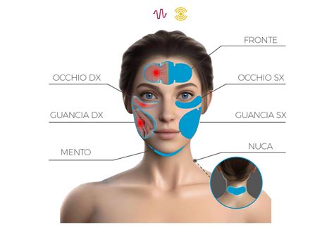 Schema del viso con aree di applicazione dei patch in silicone
