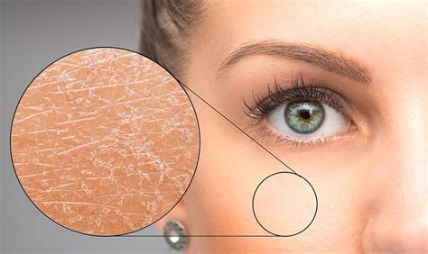 Pelle secca e sensibile